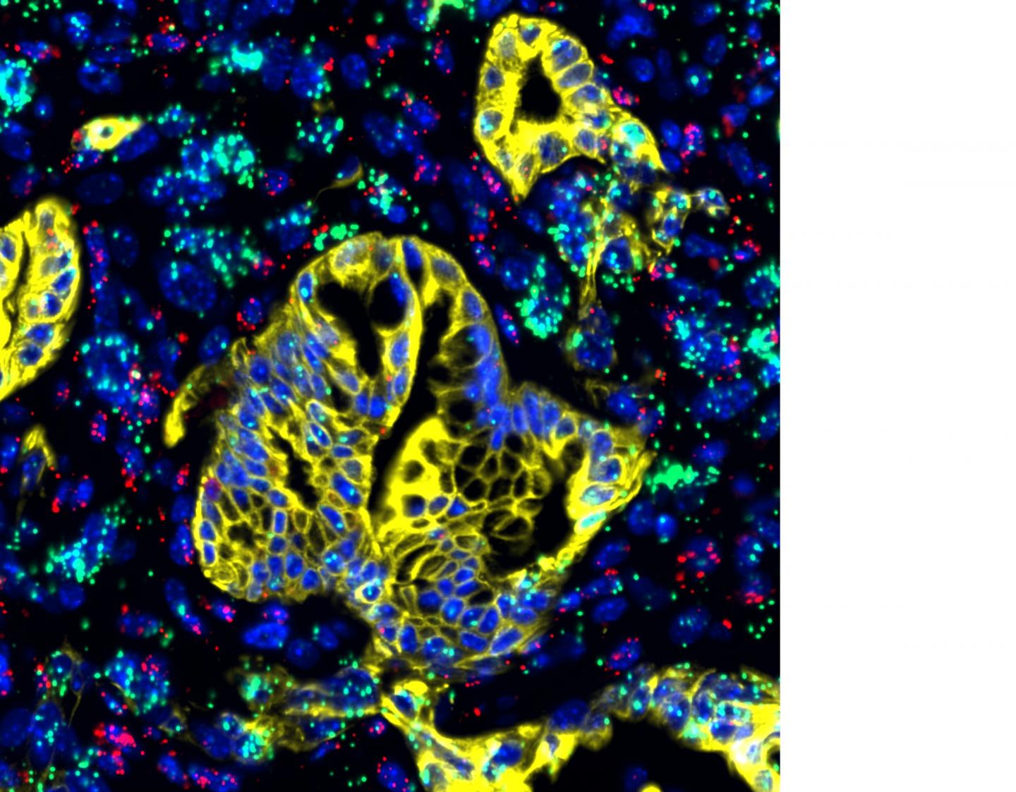 LIF Expressed in the Pancreas