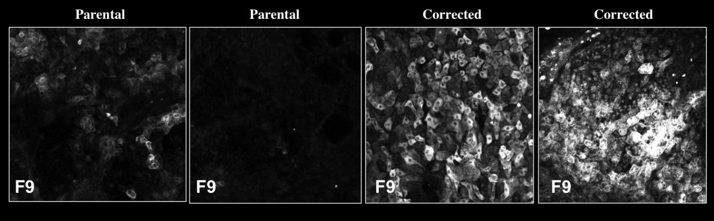 Salk Institute -- Hemophilia B -- HLCs