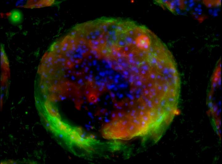 Infected Liver Cells