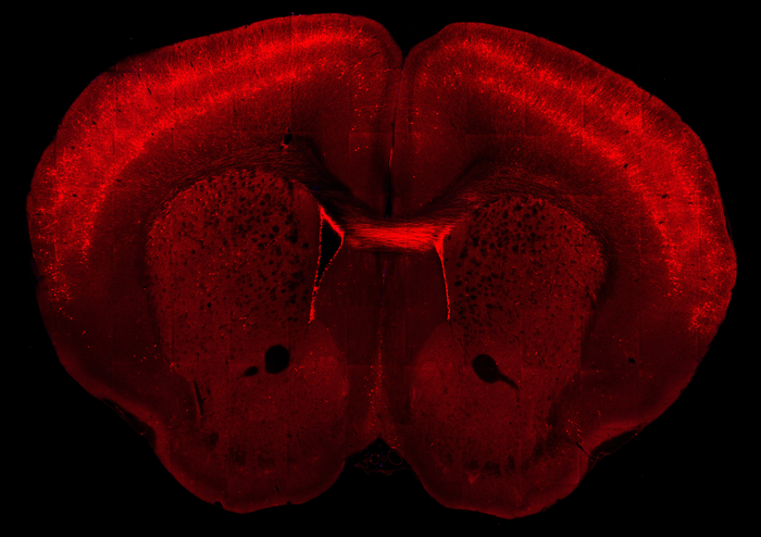 Slice through mouse brain