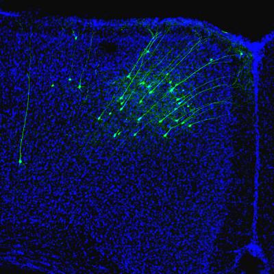 Neurons Project to Auditory Cortex