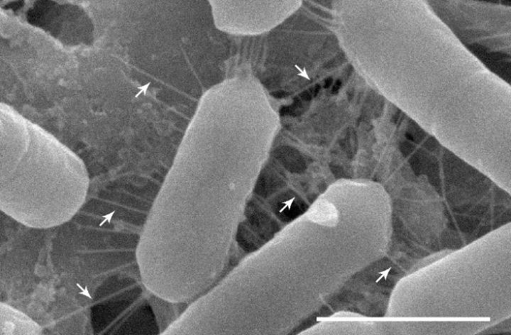 Nose Bacteria with Fimbriae