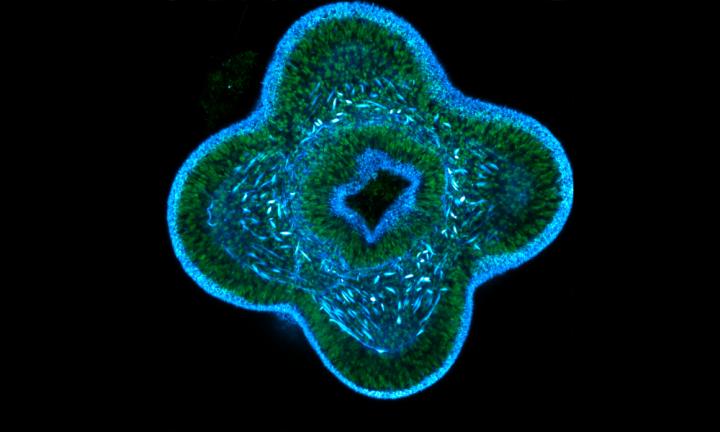 The Birth of Tentacles