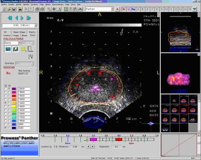 Graphical User Interface