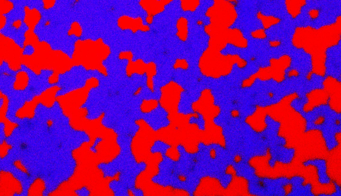 Two Strains of Warring Cholera Bacteria, Close Up