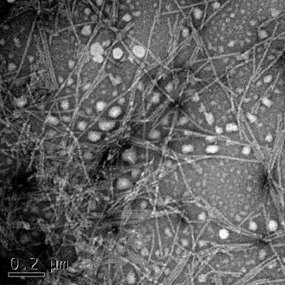 Transmission Electron Microscope Images of α-synuclein Aggregates 2