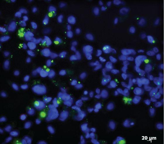 New Insights into How a Virus-Blocking Bacterium Operates in Mosquitos