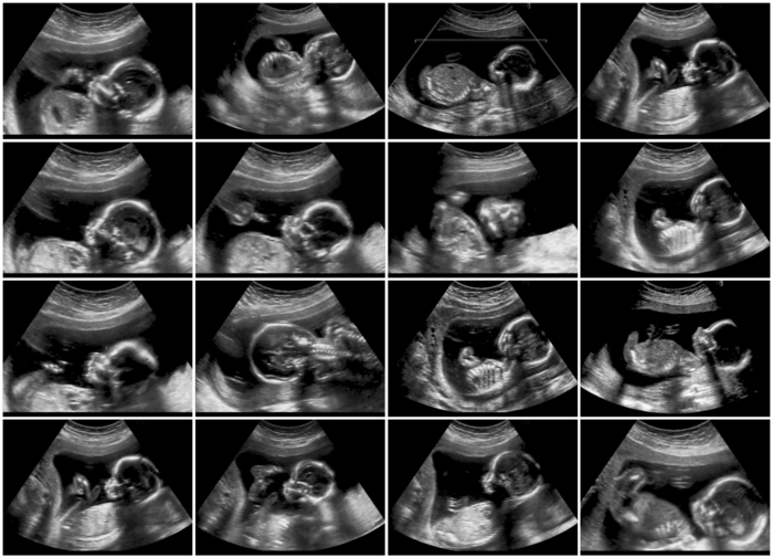 Image 2: An ultrasonography fetus scan.