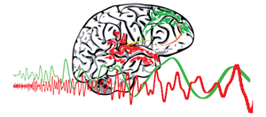 Communication defect in psychotic disorders