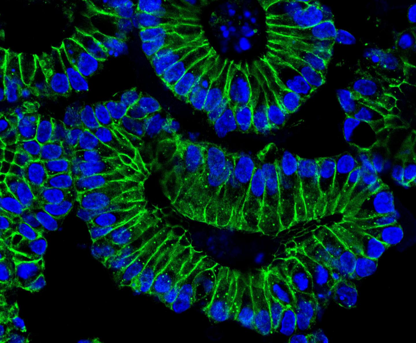 Colon organoids