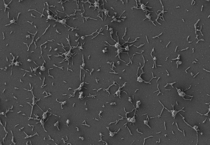 Mycoplasma pneumoniae cells