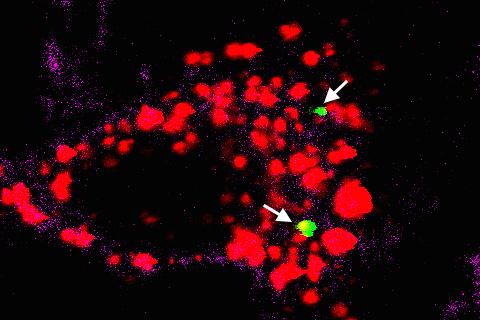 Lipopolysaccharides Invade the Endosome