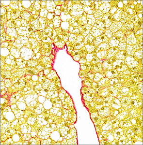 Image_Liver Tissue