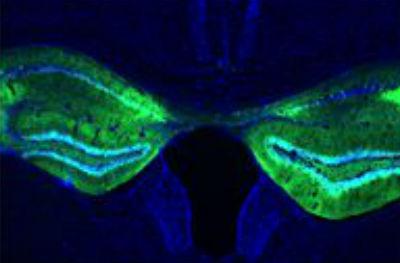 Representative GFP Expression of AMPK in the Hippocampus