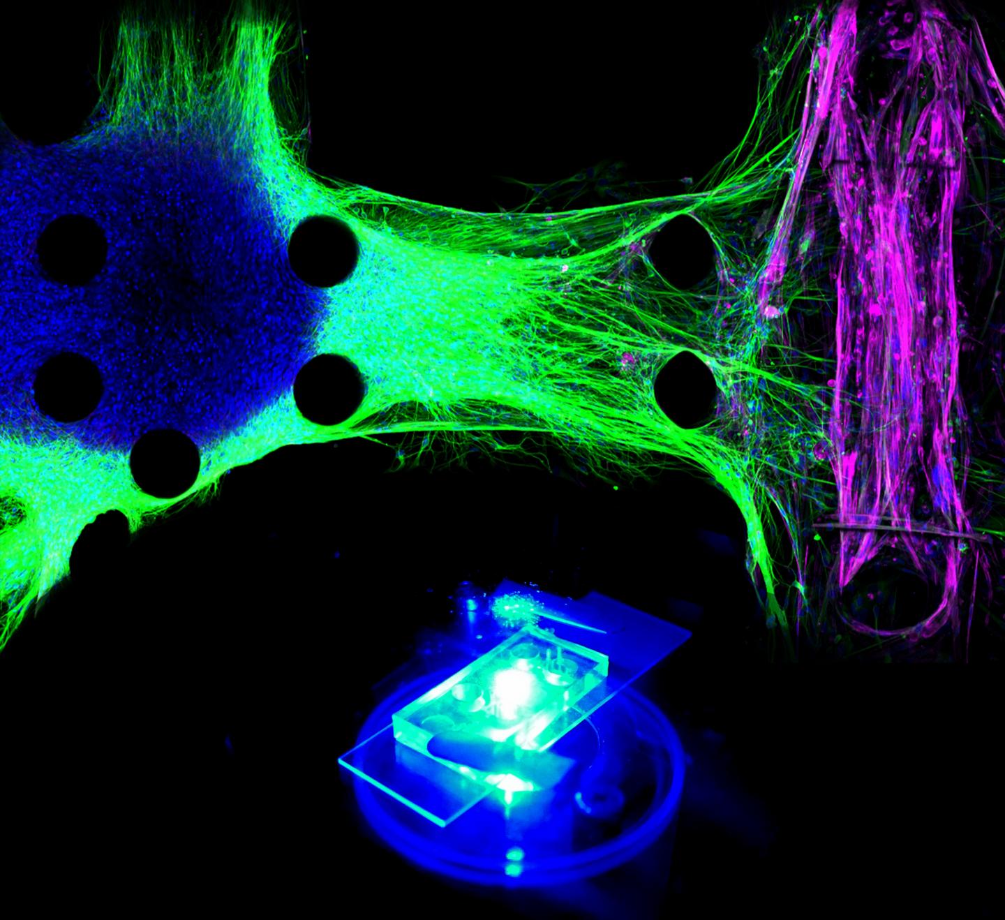 Organs-on-Chip Technology Reveals New Drug Candidates for Lou Gehrig's Disease