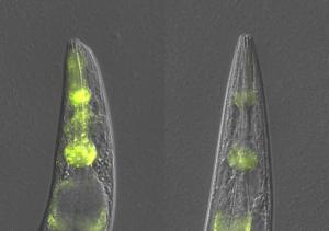 Head/upper body of two C. elegans worms with visible protein aggregates