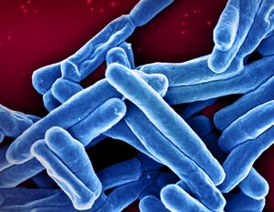 Mycobacterium tuberculosis