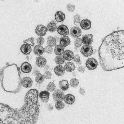 Virions in a preparation of HIV
