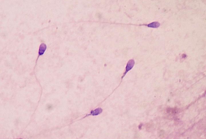 Sperm Under Microscope