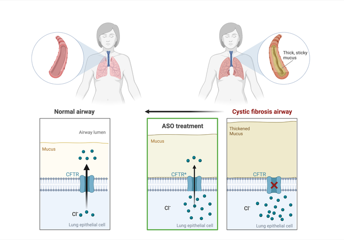 CF Airways - ASO Treatment