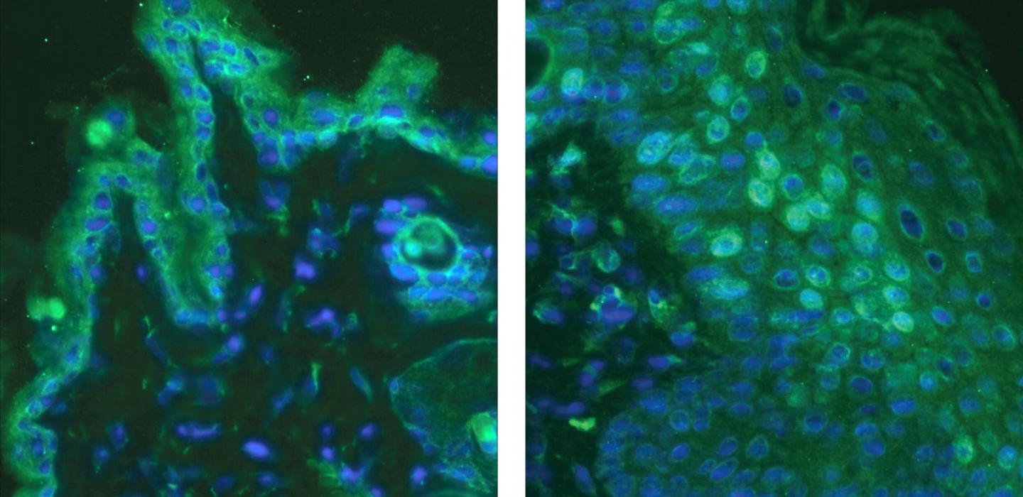 Itch Protein, Shown in Green