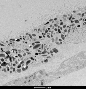 BW RPE electron microscopy