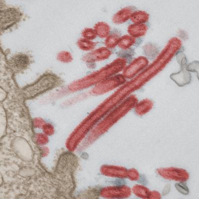 Colorized Influenza Virus