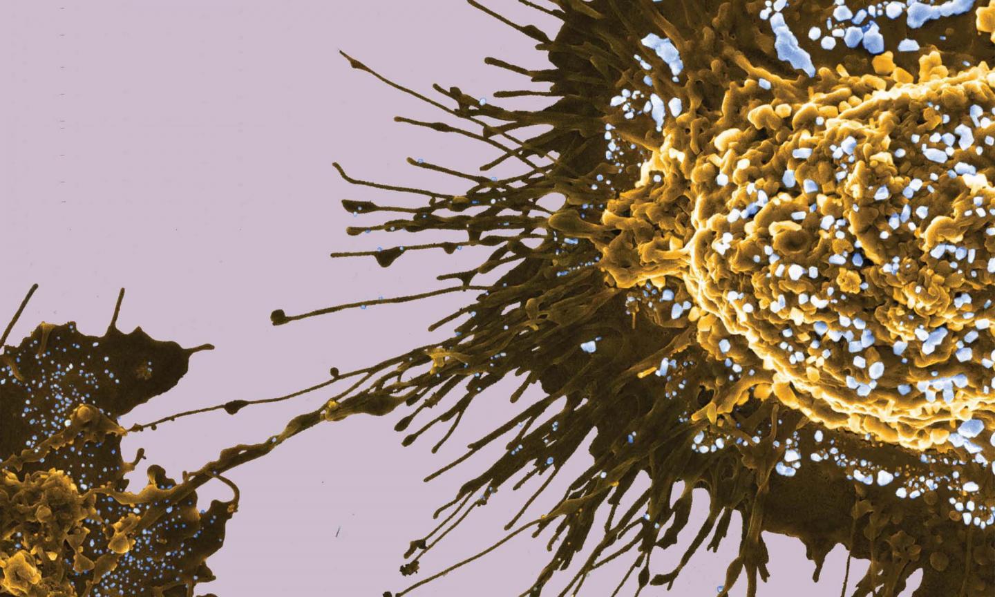 MOFs on the surface of metastasising prostate cancer cells