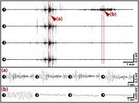 Figure 2 Measured Multichannel EEG Signals