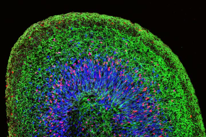 A Mini Brain Organoid, with Layered Neural Tissue and Different Groups of Neural Stem Cells