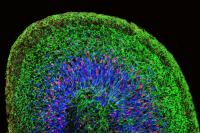 A Mini Brain Organoid, with Layered Neural Tissue and Different Groups of Neural Stem Cells