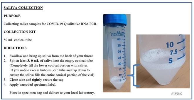 Self-collected saliva samples prove effective for diagnosing COVID-19