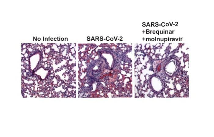 SARS-CoV-2 infection in vitro