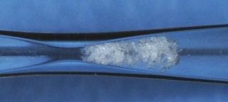 Aggressive Intensity of Cavitation Greatly Enhanced using Pressure at Bubble Collapse Region