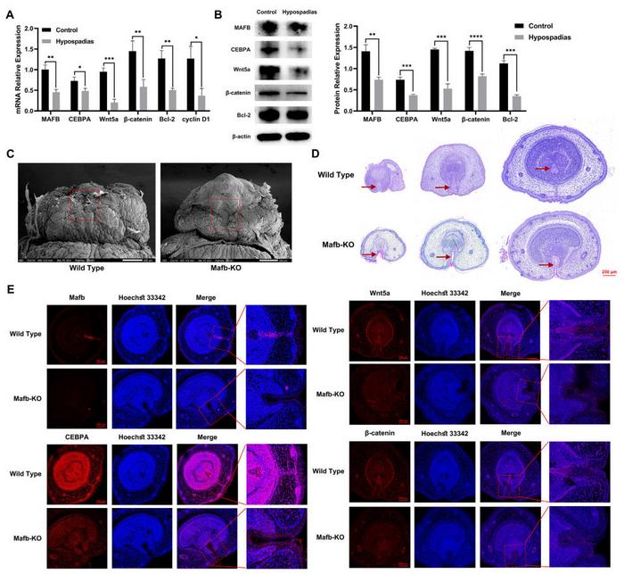 Changes in hypospadias foreskin and Mafb-KO mice GT.