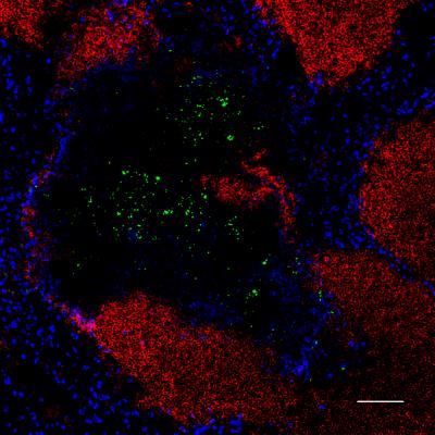 <i>Listeria</i> in the Spleen