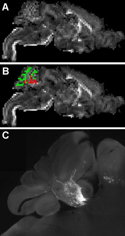 High-field MRI Scans of Mice with HuCNS-SCs Transplant