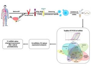 Blood cells are pelleted by centrifugation; extracellular vesicles are isolated from resulting plasma with subsequent isolation of microRNA. Sets of microRNA are studied using polymerase chain reaction and bioinformatics data analysis