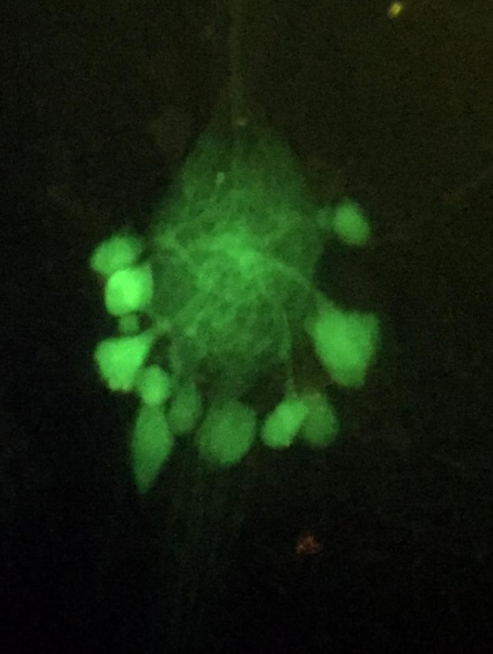 Stomatogastric Ganglion in Jonah Crab