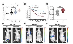 The level of circZFR is associated with CRC stage and survival, and circZFR promotes CRC growth and metastasis in vivo