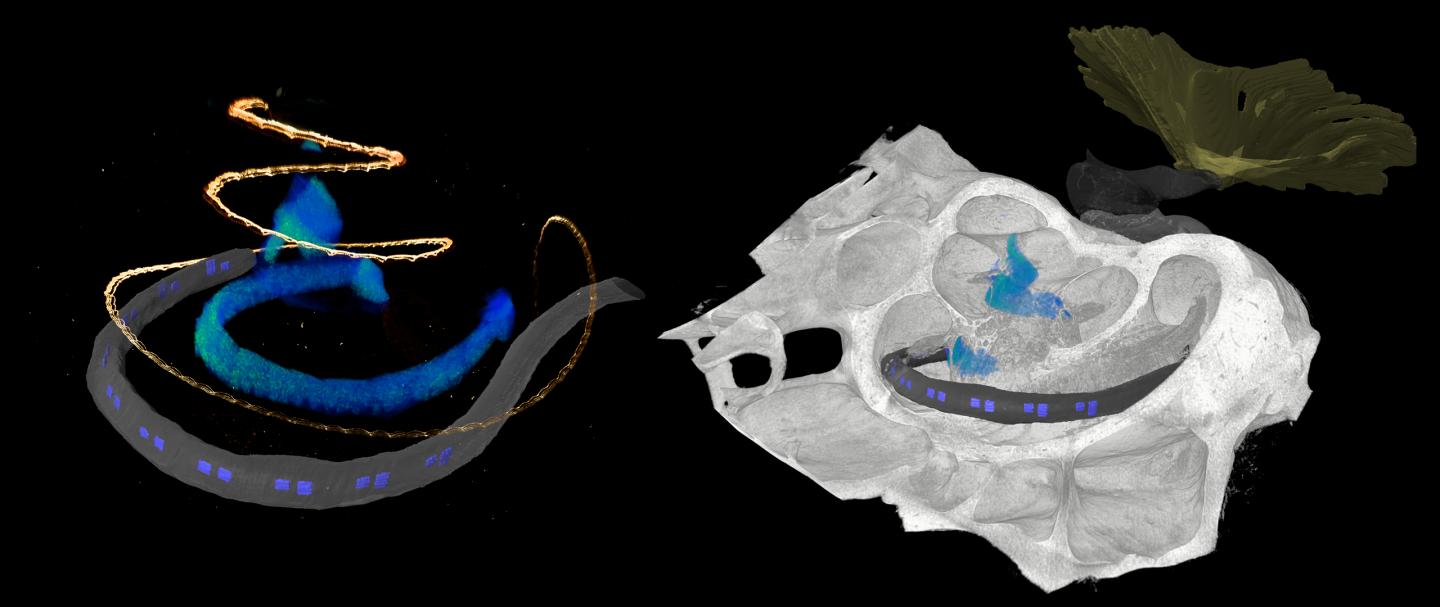 3D-Mikroskopische Aufnahme eines LED-basierten optischen Cochlea-Implantats 