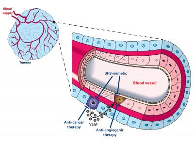 New Strategy to Attack Tumor-feeding Blood Vessels
