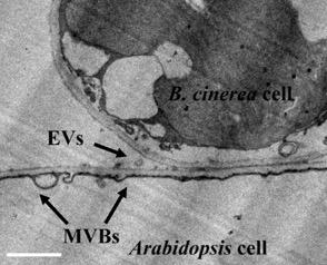 Extracellular Vesicles