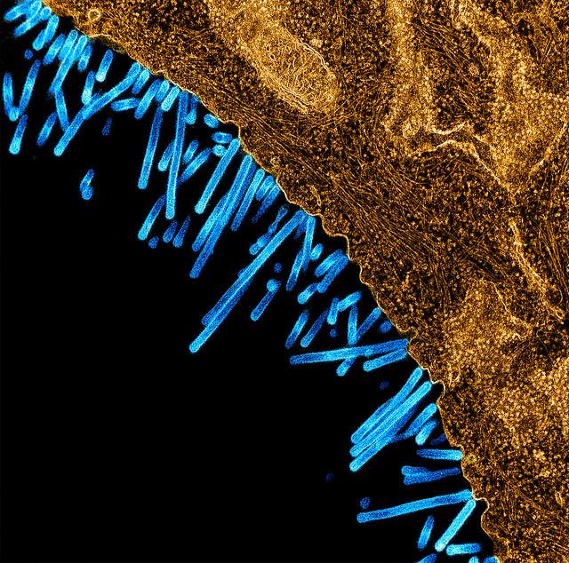 Electron Micrograph Showing a Swine Influenza Virus Particles Attached to and Budding off a Cell