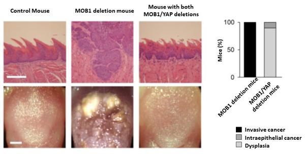 Figure 2. Tongue cancer formation dependent on YAP when MOB1 is deleted
