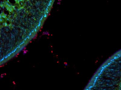 How Microbes Make it Past Tight Spaces Between Cells