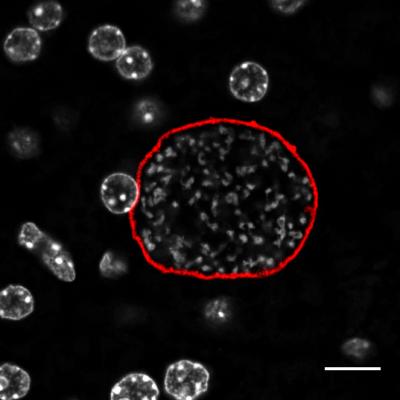 <i>Plasmodium</i> Parasite Inside Liver Cell