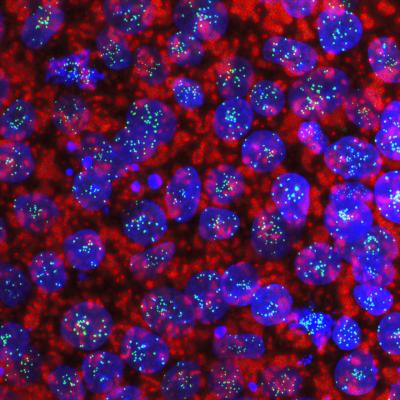 Haploid Human Embryonic Stem Cells