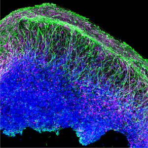 Single neural rosette-derived organoids model aspects of the brain