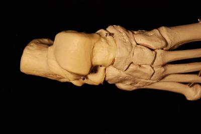 Using Tarsal Bones to Identify Sex of Skeletal Remains